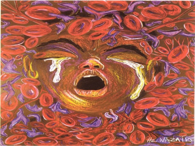 Ten Redefined Sickle